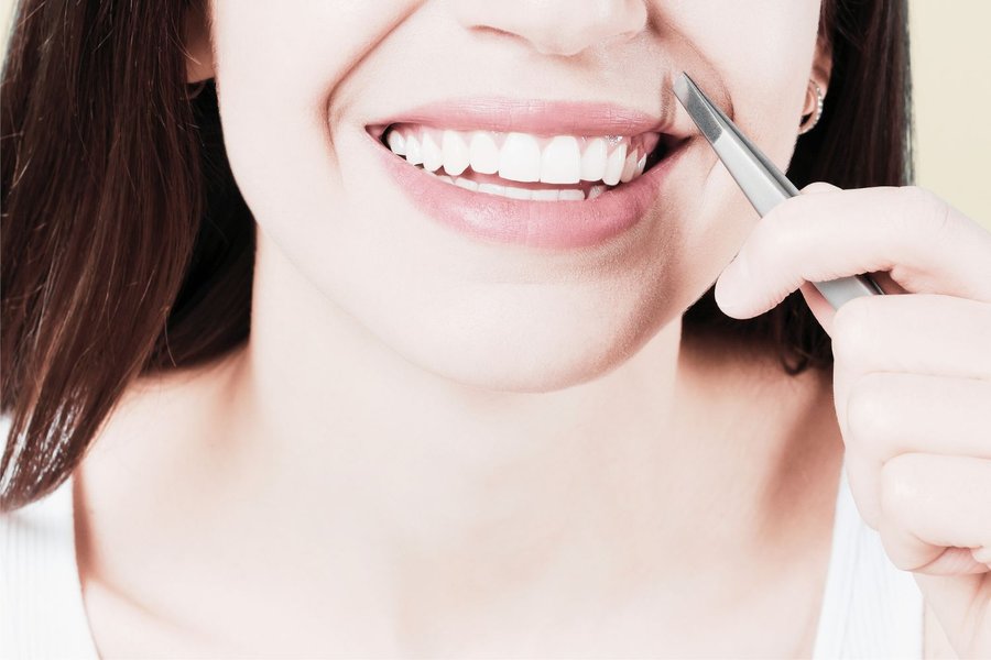 résultat thermolyse femme souriante satisfaite