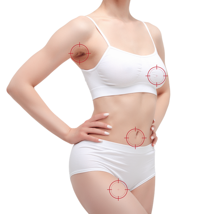 zones de traitement thermolyse corps aréoles nombril cuisses