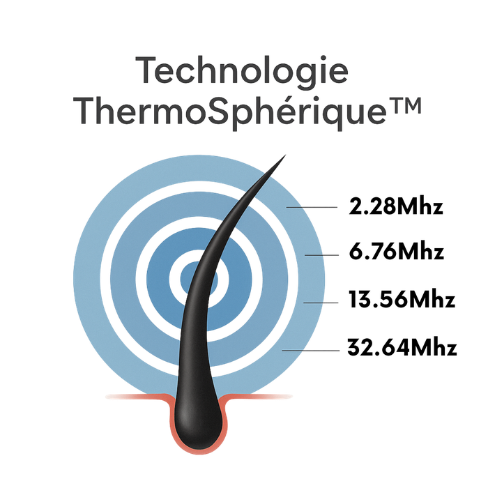 Technologie ThermoSphérique™ — 4 fréquences 2.28 6.76 13.56 32.64 MHz follicule